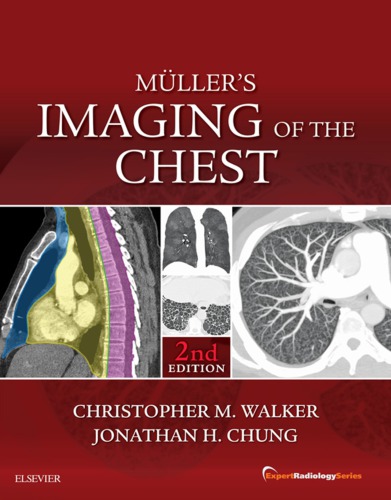 Muller’s Imaging of the Chest (PDF Instant Download)