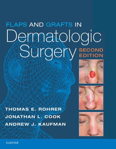 Flaps and Grafts in Dermatologic Surgery (PDF Instant Download)