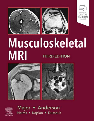 Musculoskeletal MRI (PDF Instant Download)