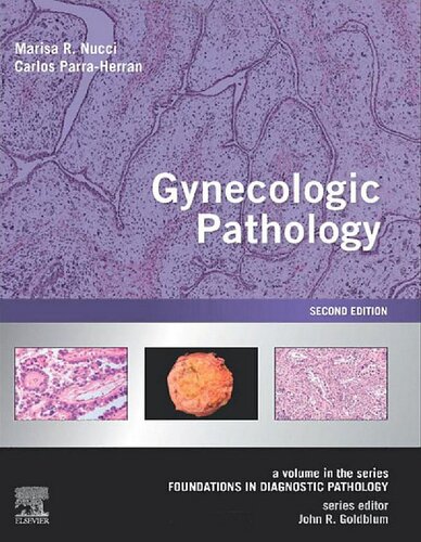 Gynecologic Pathology: A Volume in Foundations in Diagnostic Pathology Series (PDF Instant Download)