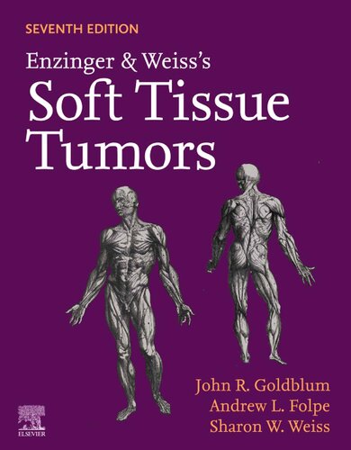 Enzinger and Weiss's Soft Tissue Tumors (PDF Instant Download)
