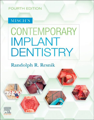 Misch's Contemporary Implant Dentistry (PDF Instant Download)
