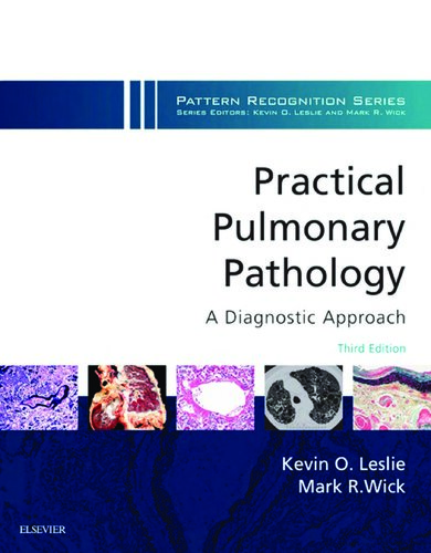 Practical Pulmonary Pathology: A Diagnostic Approach: A Volume in the Pattern Recognition Series (PDF Instant Download)