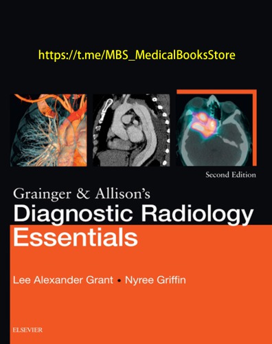 Grainger and Allison's Diagnostic Radiology Essentials E-Book (PDF Instant Download)