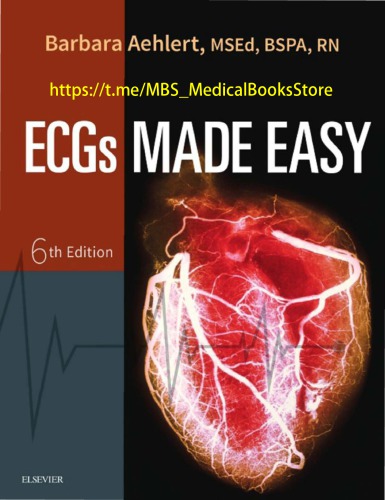 ECGs Made Easy (PDF Instant Download)