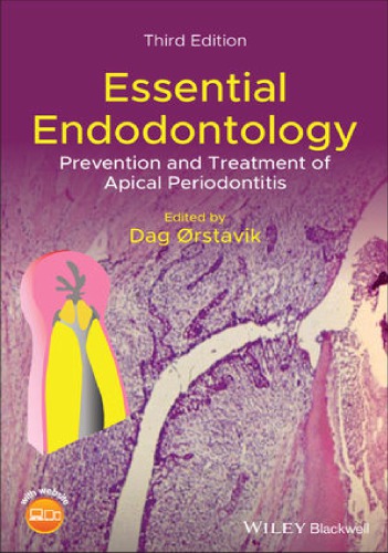 Essential Endodontology: Prevention and Treatment of Apical Periodontitis (PDF Instant Download)