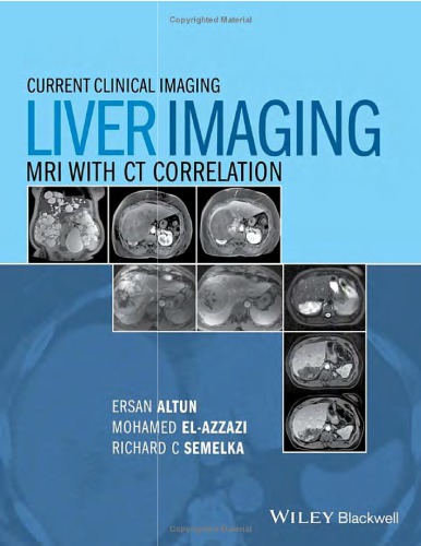 Liver imagaing MRI with CT correlation. (PDF Instant Download)