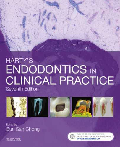 Harty’s Endodontics in Clinical Practice. (PDF Instant Download)