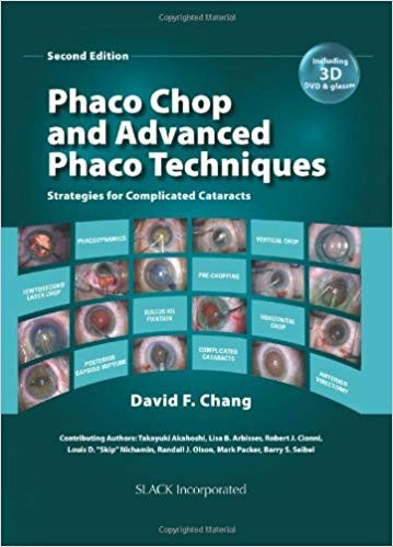 Phaco Chop and Advanced Phaco Techniques: Strategies for Complicated Cataracts 2nd Edition (PDF Instant Download)