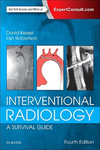 Interventional Radiology: A Survival Guide (PDF Instant Download)