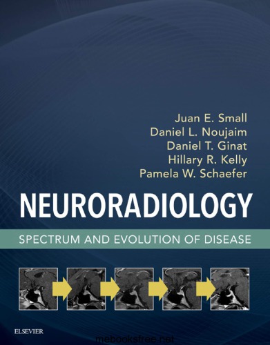 Neuroradiology: Spectrum and Evolution of Disease (PDF Instant Download)