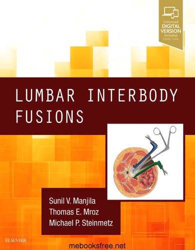 Lumbar Interbody Fusions (PDF Instant Download)