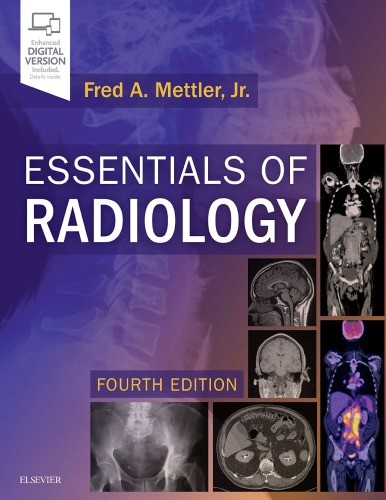 Essentials of Radiology: Common Indications and Interpretation (PDF Instant Download)