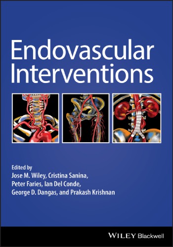 Endovascular Therapies (PDF Instant Download)