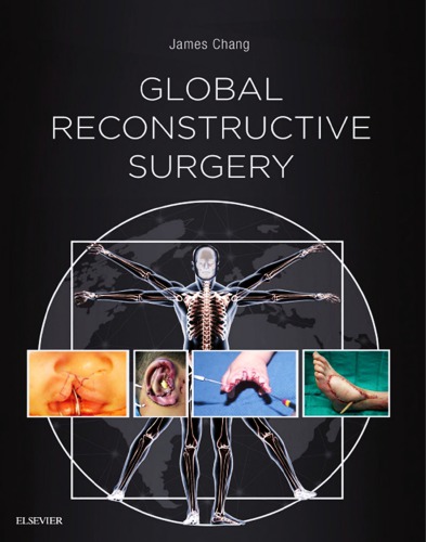 Global Reconstructive Surgery (PDF Instant Download)