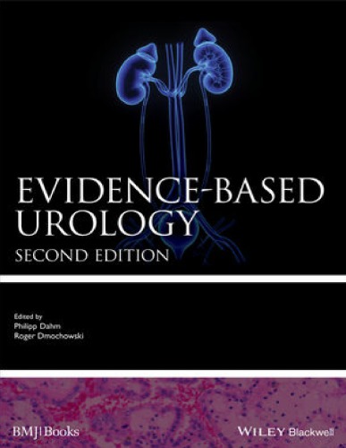 Evidence‐Based Urology (PDF Instant Download)