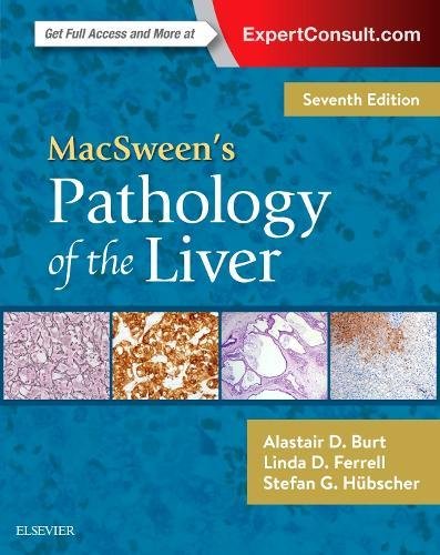 MacSween’s Pathology of the Liver (PDF Instant Download)