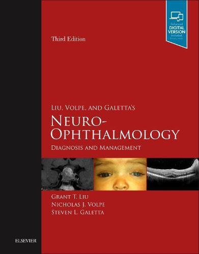 Liu, Volpe, and Galetta’s Neuro-Ophthalmology: Diagnosis and Management, 3e (PDF Instant Download)