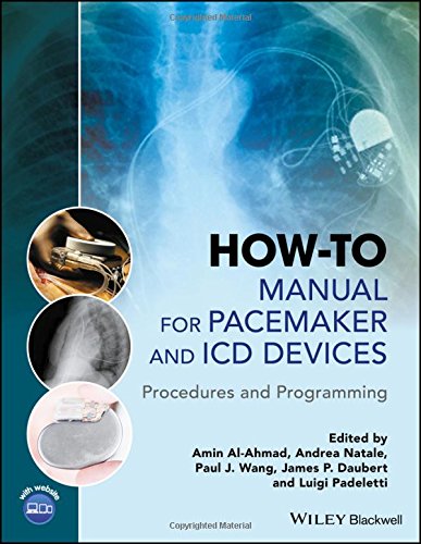 How-to Manual for Pacemaker and ICD Devices: Procedures and Programming (PDF Instant Download)
