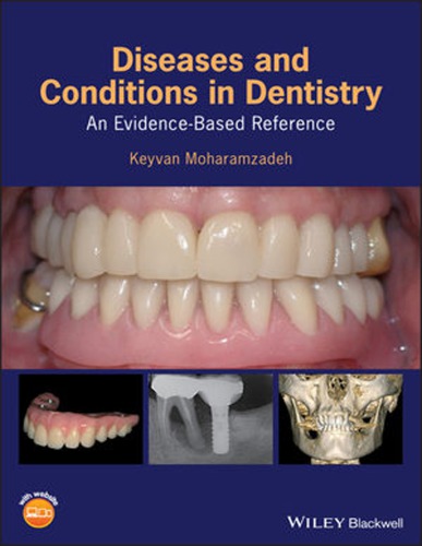 Diseases and conditions in dentistry : an evidence-based reference (PDF Instant Download)