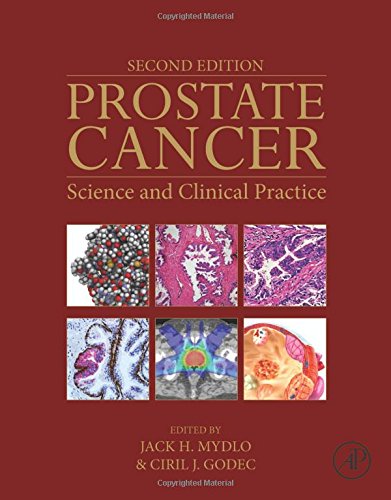 Prostate Cancer, Second Edition: Science and Clinical Practice (PDF Instant Download)