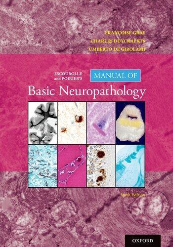 Escourolle And Poiriers Manual Of Basic Neuropathology 6Th Edition (PDF Instant Download)