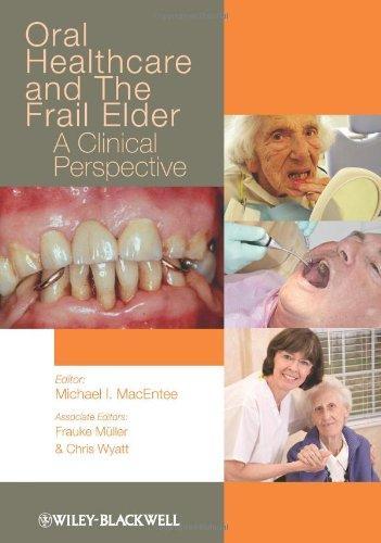 Oral Healthcare And The Frail Elder Chris Wyatt (PDF Instant Download)