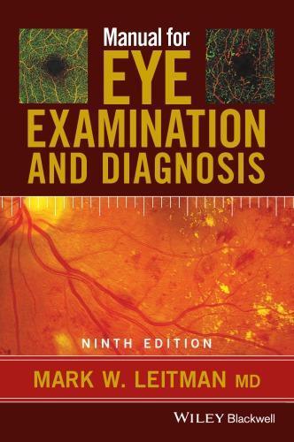 Manual For Eye Examination And Diagnosis 9Th Edition (PDF Instant Download)