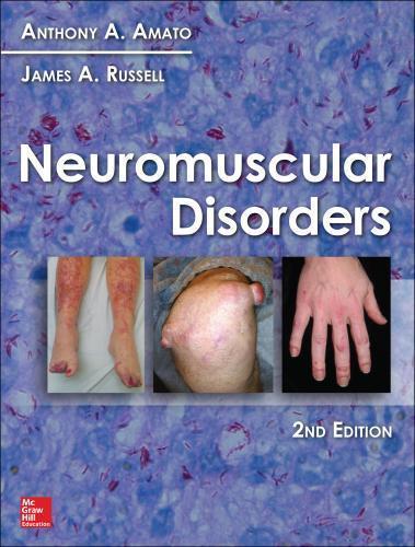 Neuromuscular Disorders 2Nd Edition Amato (PDF Instant Download)