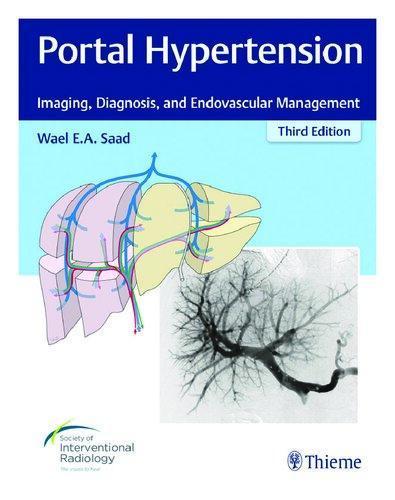 Portal Hypertension Imaging Diagnosis And Endovascular Management 3Rd Edition (PDF Instant Download)