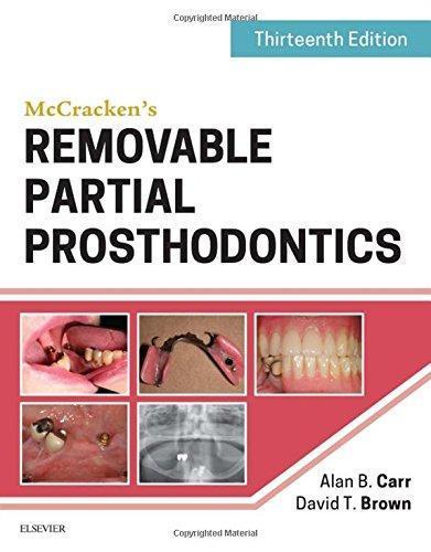 Mccrackens Removable Partial Prosthodontics 13Th Edition (PDF Instant Download)