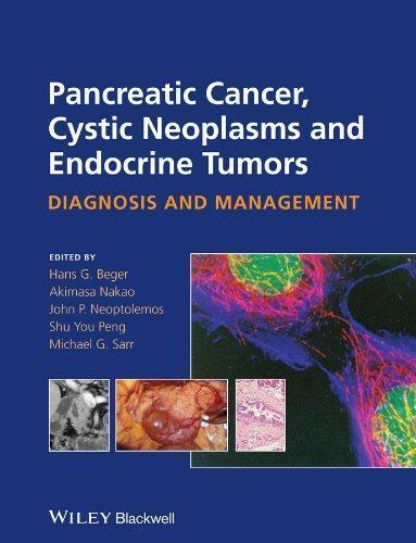 Pancreatic Cancer Cystic Neoplasms And Endocrine Tumors Diagnosis And Management (PDF Instant Download)