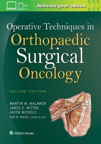 Operative Techniques In Orthopaedic Surgical Oncology 2Nd Edition (PDF Instant Download)