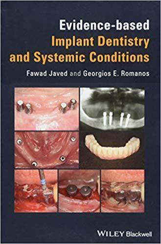 Evidence Based Implant Dentistry And Systemic Conditions (PDF Instant Download)