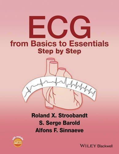 Ecg From Basics To Essentials Step (PDF Instant Download)