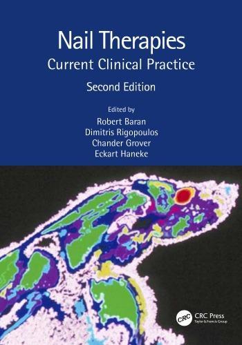 Nail Therapies Current Clinical Practice 2Nd Edition (PDF Instant Download)