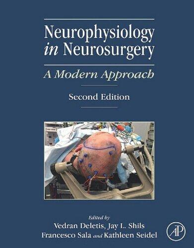 Neurophysiology In Neurosurgery A Modern Approach 2Nd Edition (PDF Instant Download)