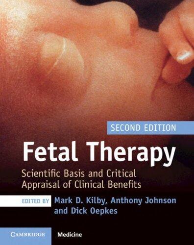 Fetal Therapy Scientific Basis And Critical Appraisal Of Clinical Benefits 2Nd Edition (PDF Instant Download)