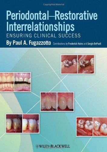 Periodontal Restorative Interrelationships (PDF Instant Download)