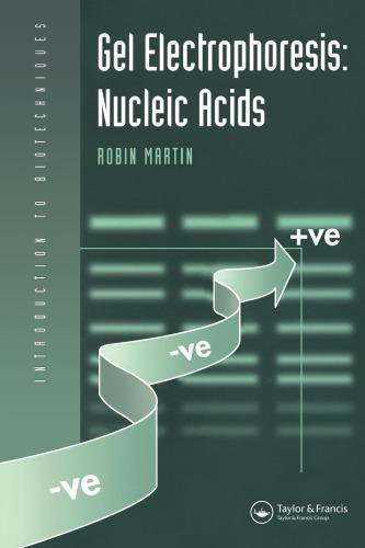 Gel Electrophoresisds Nucleic Acids (PDF Instant Download)