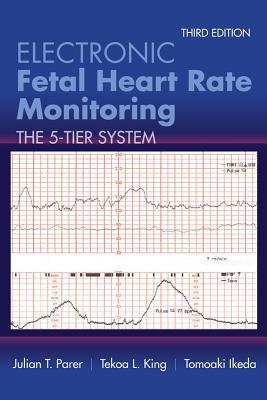 Electronic Fetal Heart Rate Monitoring The 5 Tier System 3Rd Edition (PDF Instant Download)