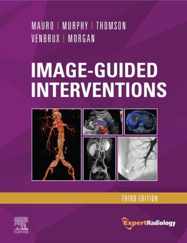 Image Guided Interventions Expert Radiology Series 3Rd Edition (PDF Instant Download)