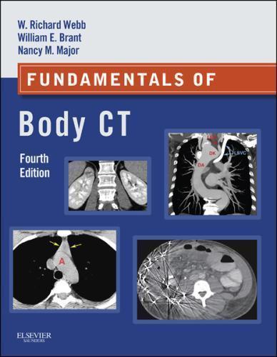 Fundamentals Of Body Ct 4Th Edition (PDF Instant Download)