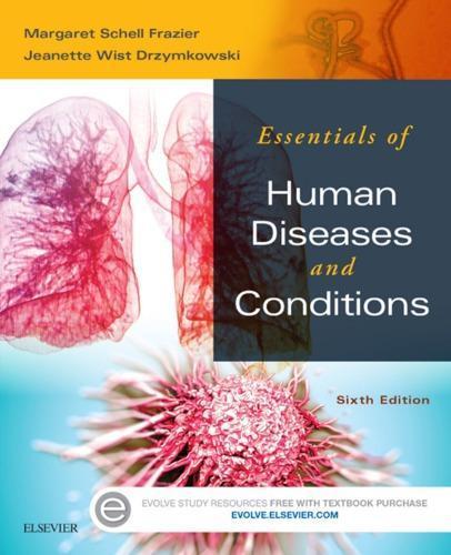 Essentials Of Human Diseases And Conditions 6Th Edition (PDF Instant Download)