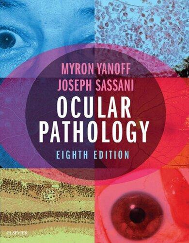 Ocular Pathology 8Th Edition (PDF Instant Download)