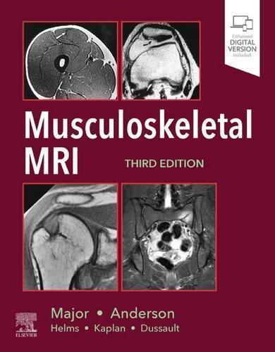 Musculoskeletal Mri 3Rd Edition (PDF Instant Download)