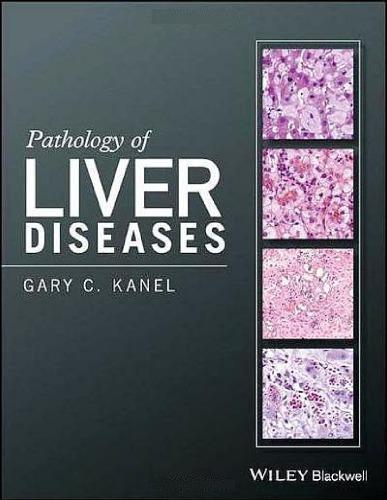 Pathology Of Liver Diseases (PDF Instant Download)