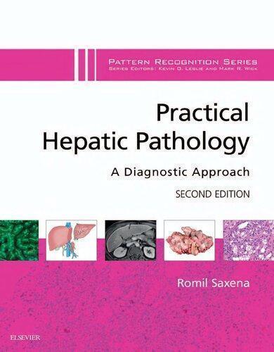 Practical Hepatic Pathology A Diagnostic Approach 2Nd Edition (PDF Instant Download)