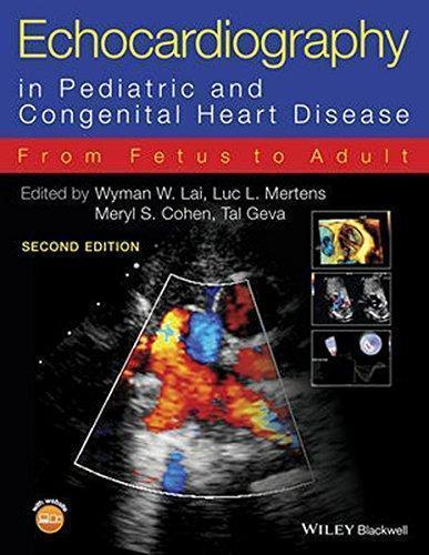 Echocardiography In Pediatric And Congenital Heart Disease From Fetus To Adult 2Nd Edition (PDF Instant Download)