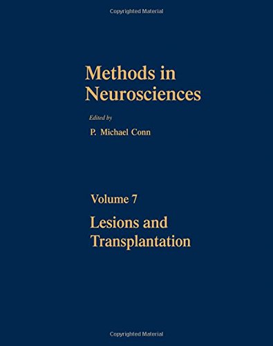 Lesions and Transplantation  Edition (PDF Instant Download)